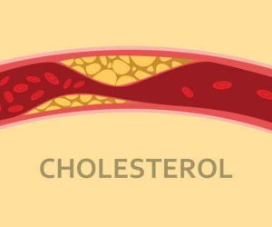 كيف نخفض مستوى الكوليسترول بالدم من دون أدوية؟